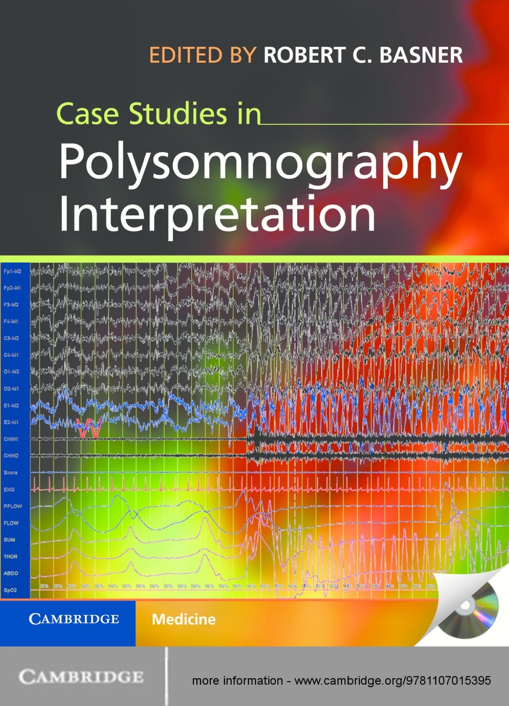 Case Studies in Polysomnography Interpretation 1st Edition â€“ PDF/EPUB Version Downloadable