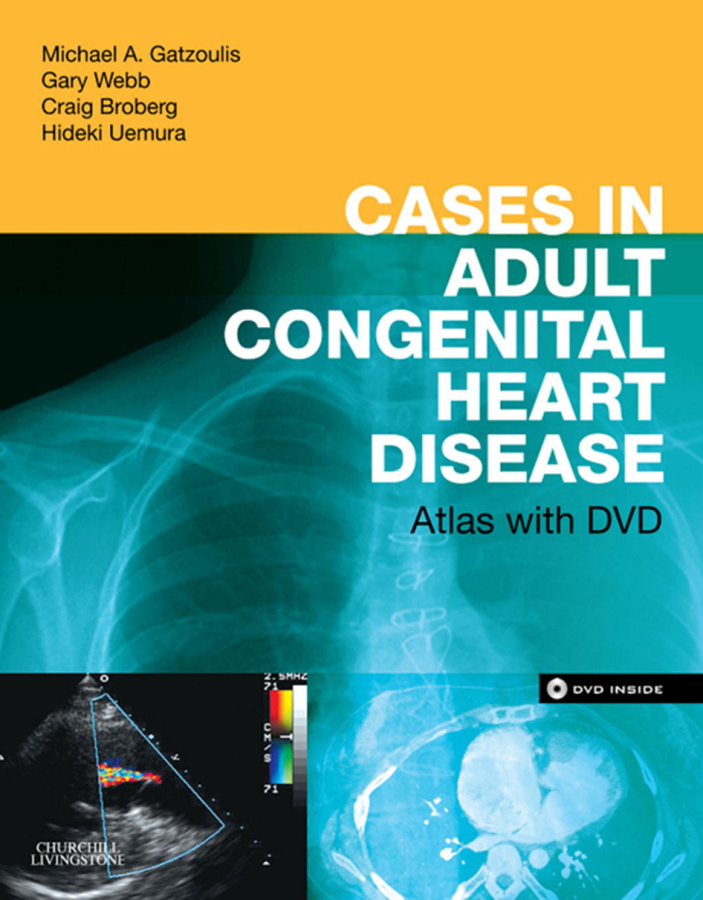 Cases in Adult Congenital Heart Disease Atlas â€“ PDF/EPUB Version Downloadable