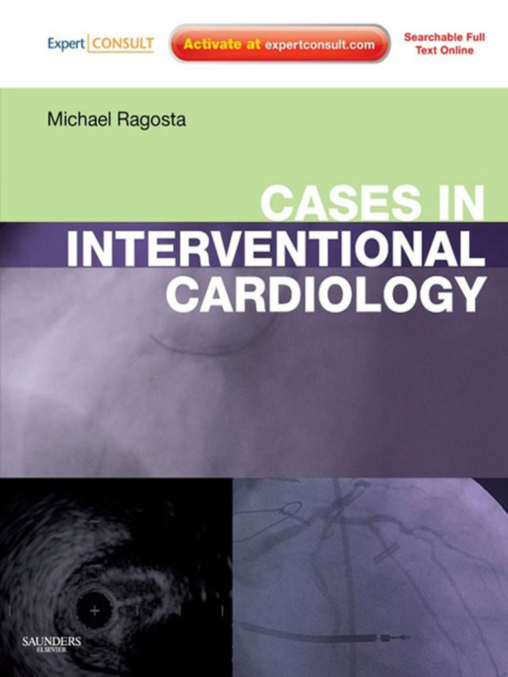 Cases in Interventional Cardiology  â€“ PDF/EPUB Version Downloadable