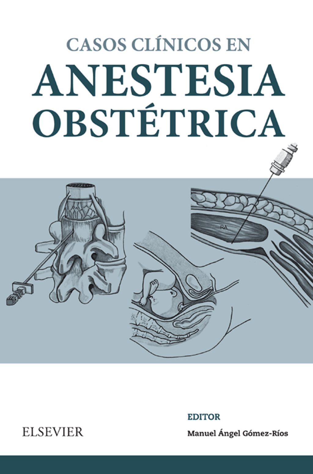 Casos ClÃ­nicos en anestesia obstÃ©trica - (PDF/EPUB Version)