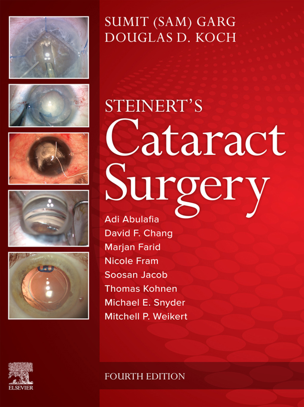 Cataract Surgery 4th Edition â€“ PDF/EPUB Version Downloadable