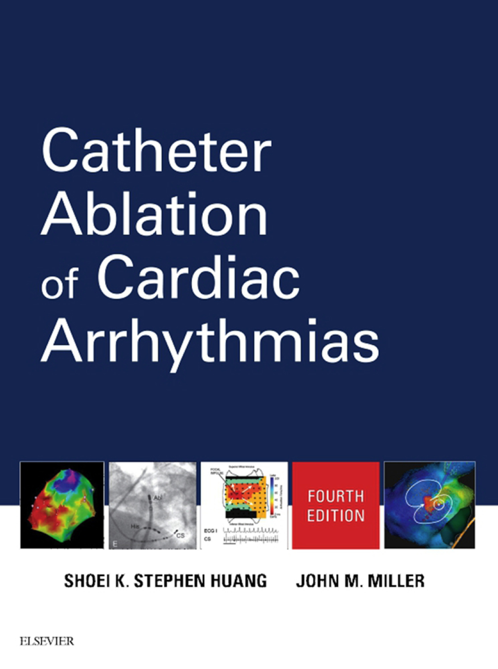Catheter Ablation of Cardiac Arrhythmias 4th Edition â€“ PDF/EPUB Version Downloadable