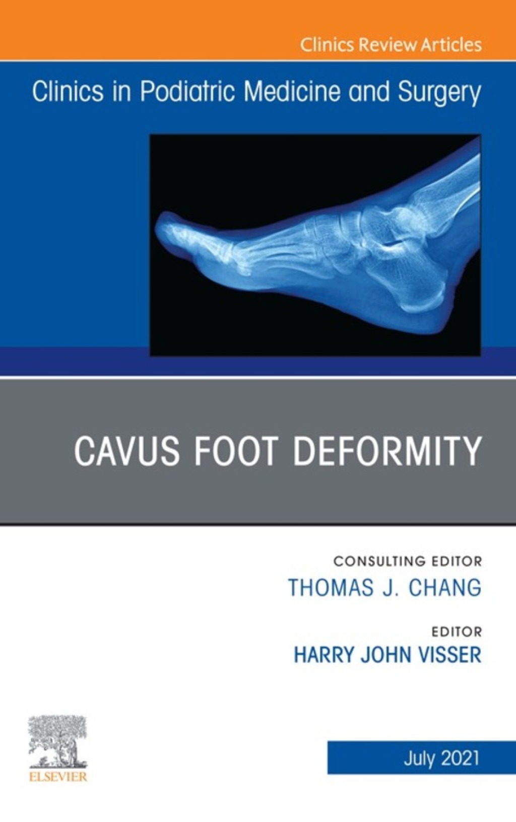 Cavus Foot Deformity, An Issue of Clinics in Podiatric Medicine and Surgery  â€“ PDF/EPUB Version Downloadable