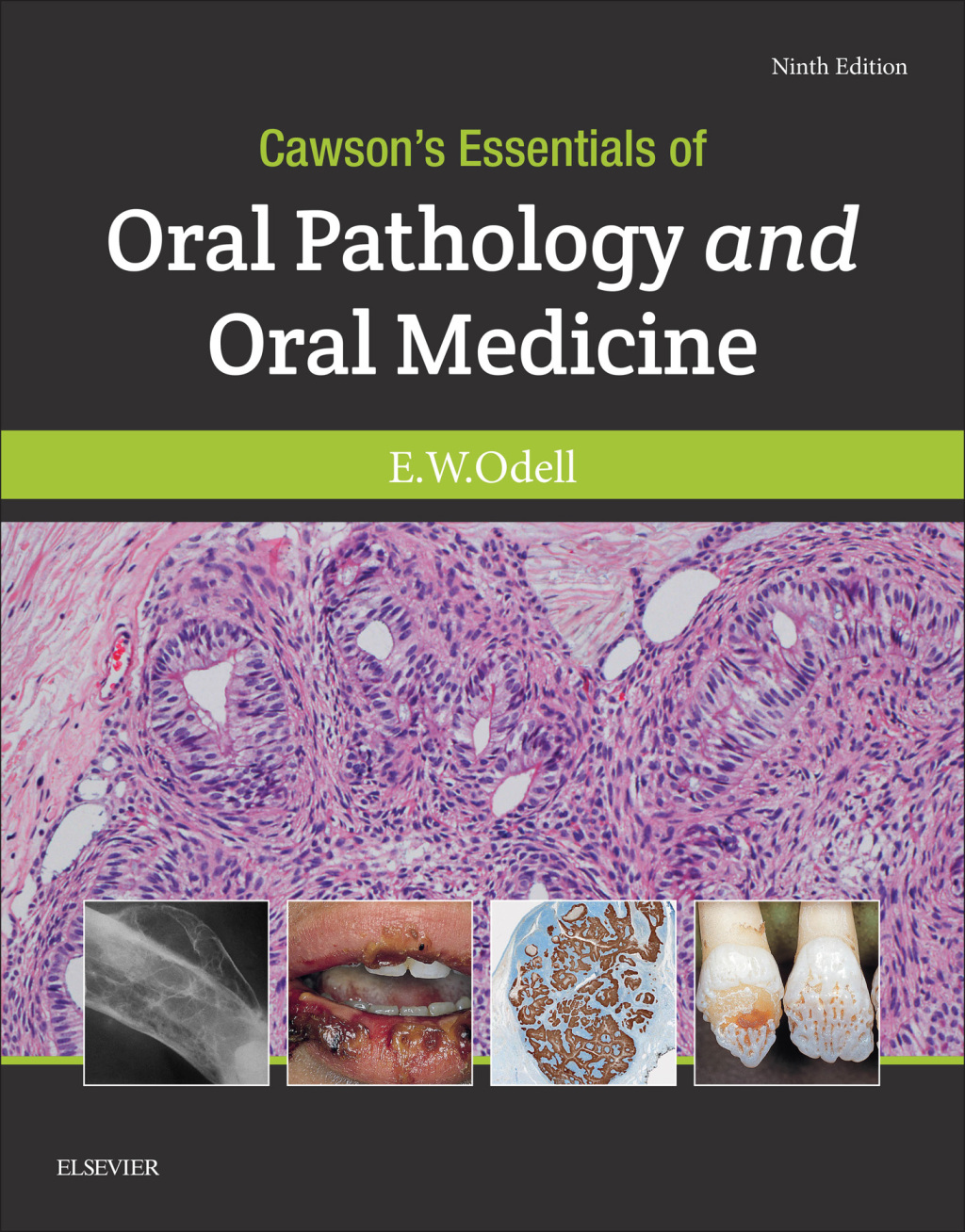 Cawson's Essentials of Oral Pathology and Oral Medicine 9th Edition – PDF/EPUB Version Downloadable Cawson's Essentials of Oral Pathology and Oral Medicine 9th Edition – PDF/EPUB Version Downloadable - Image 1