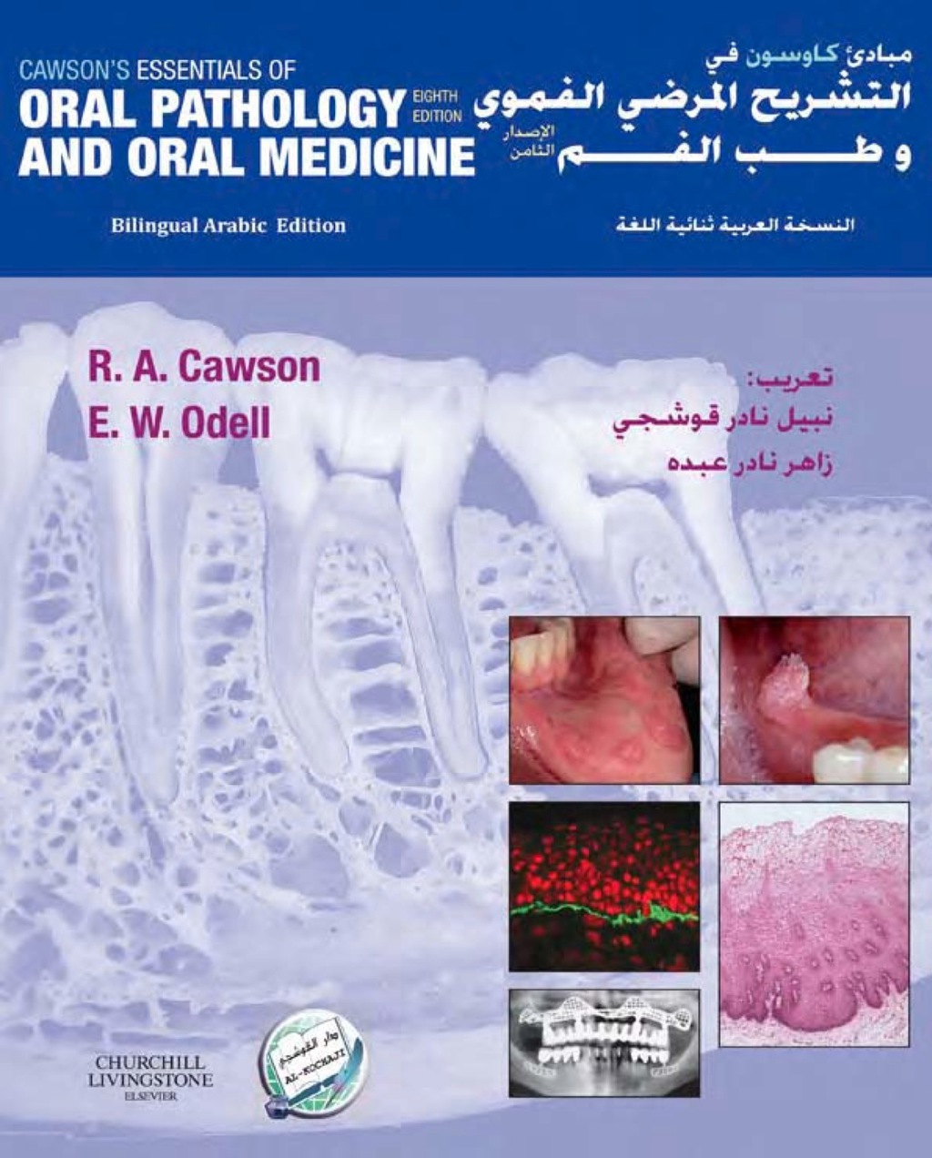 Cawson's Essentials of Oral Pathology and Oral Medicine : Arabic Bilingual Edition 8th Edition â€“ PDF/EPUB Version Downloadable