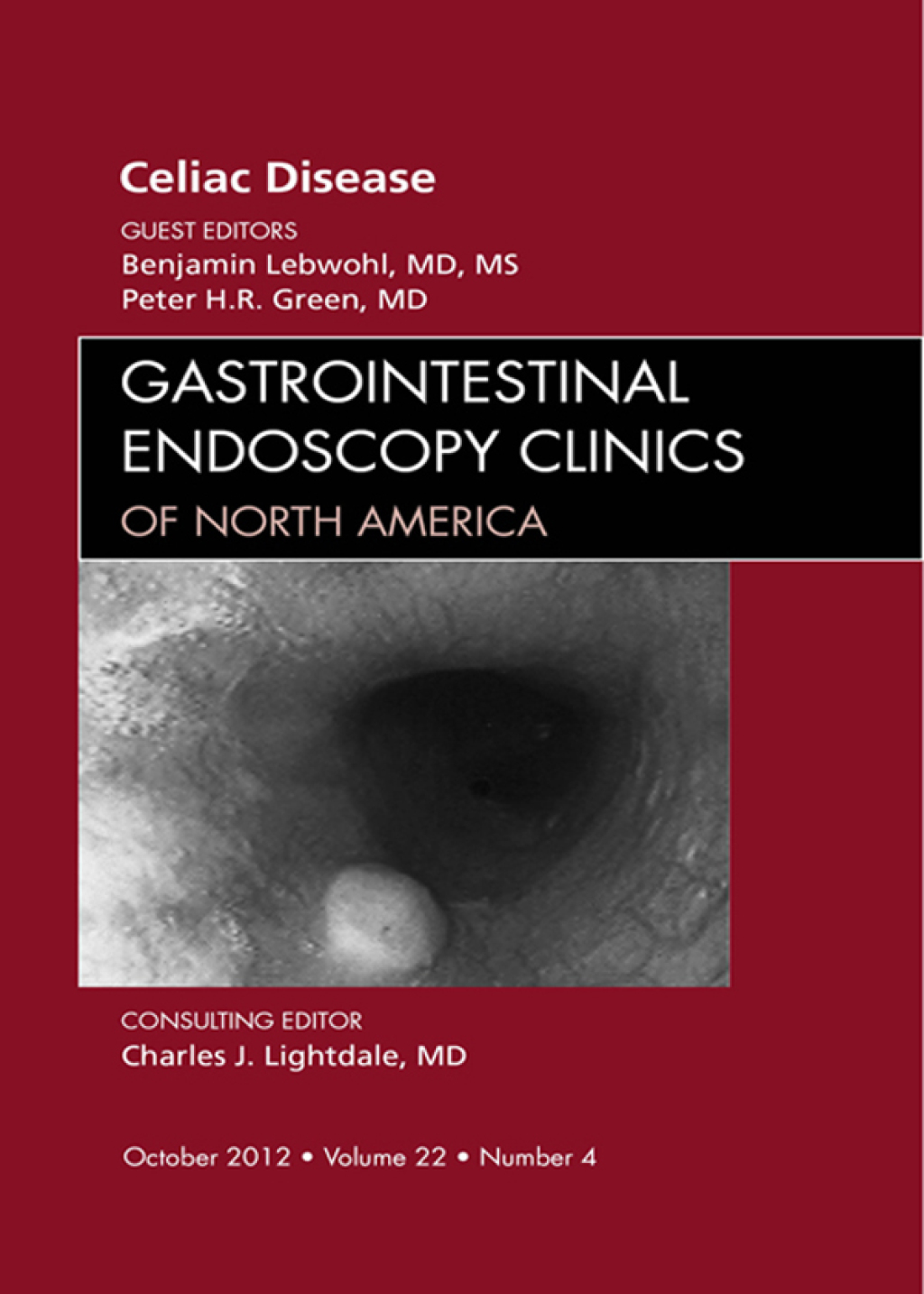 Celiac Disease, An Issue of Gastrointestinal Endoscopy Clinics – PDF/EPUB Version Downloadable Celiac Disease, An Issue of Gastrointestinal Endoscopy Clinics – PDF/EPUB Version Downloadable - Image 1