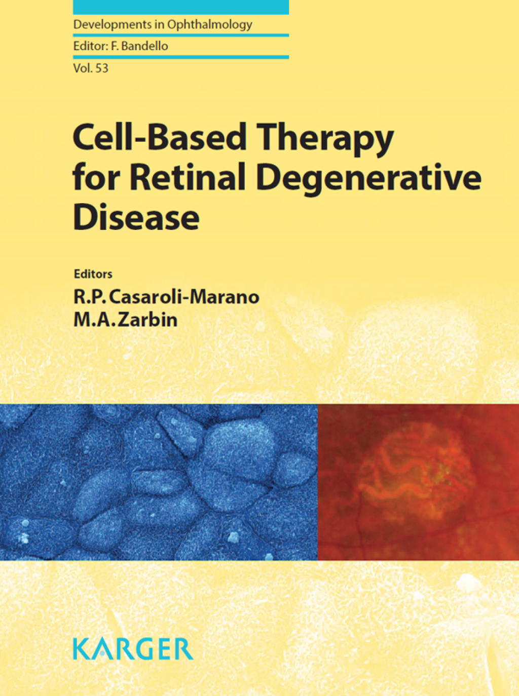 Cell-Based Therapy for Retinal Degenerative Disease 1st Edition â€“ PDF/EPUB Version Downloadable