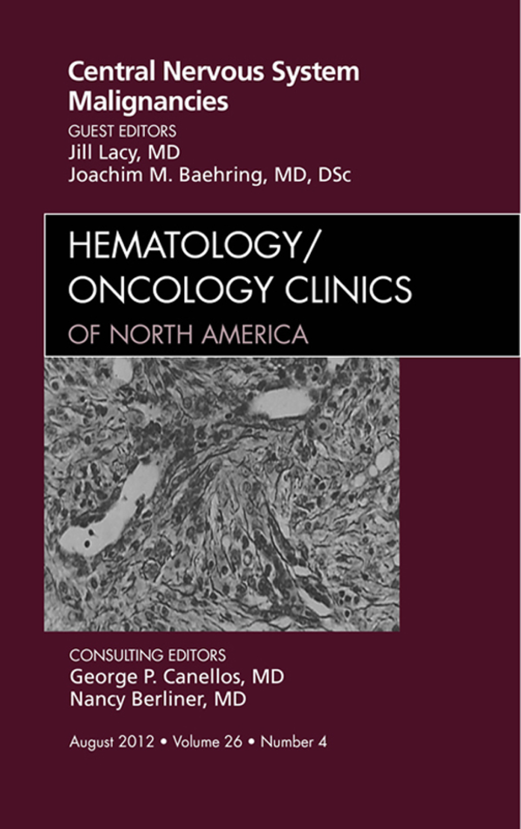 Central Nervous System Malignancies, An Issue of Hematology/Oncology Clinics of North America  â€“ PDF/EPUB Version Downloadable