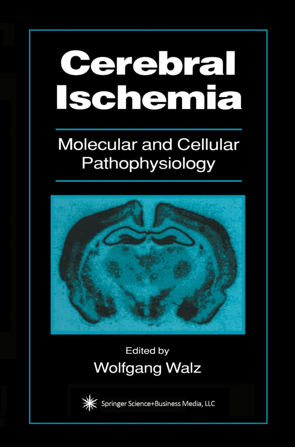 Cerebral Ischemia Molecular and Cellular Pathophysiology 1st Edition â ...