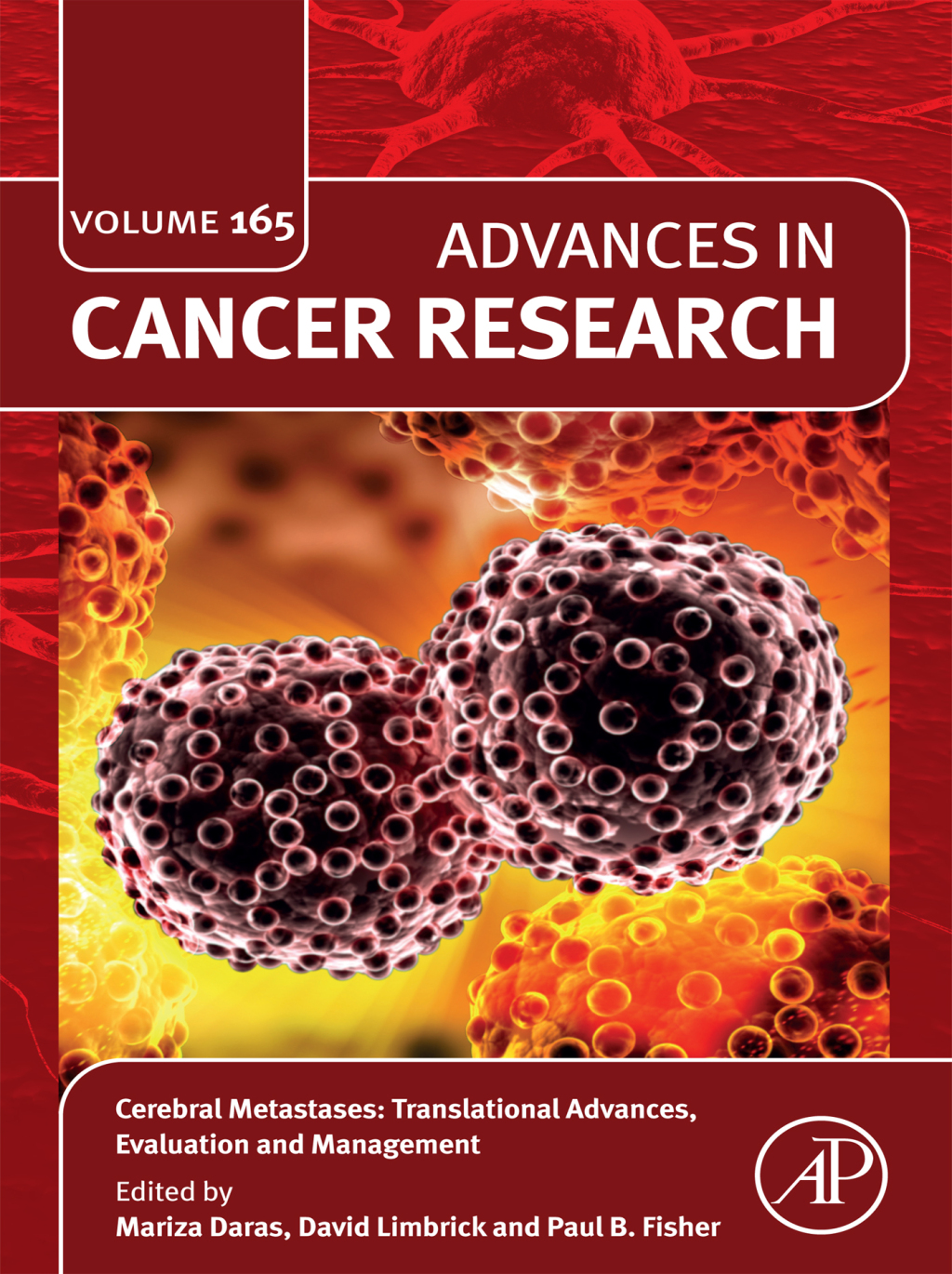 Cerebral Metastases: Translational Advances, Evaluation and Management â€“ PDF/EPUB Version Downloadable