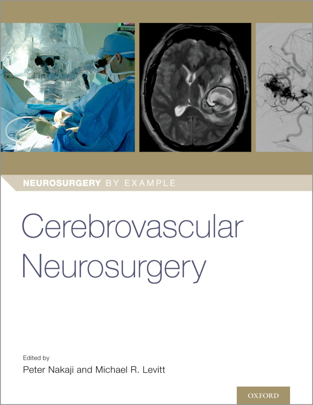 Cerebrovascular Neurosurgery 1st Edition â€“ PDF/EPUB Version Downloadable