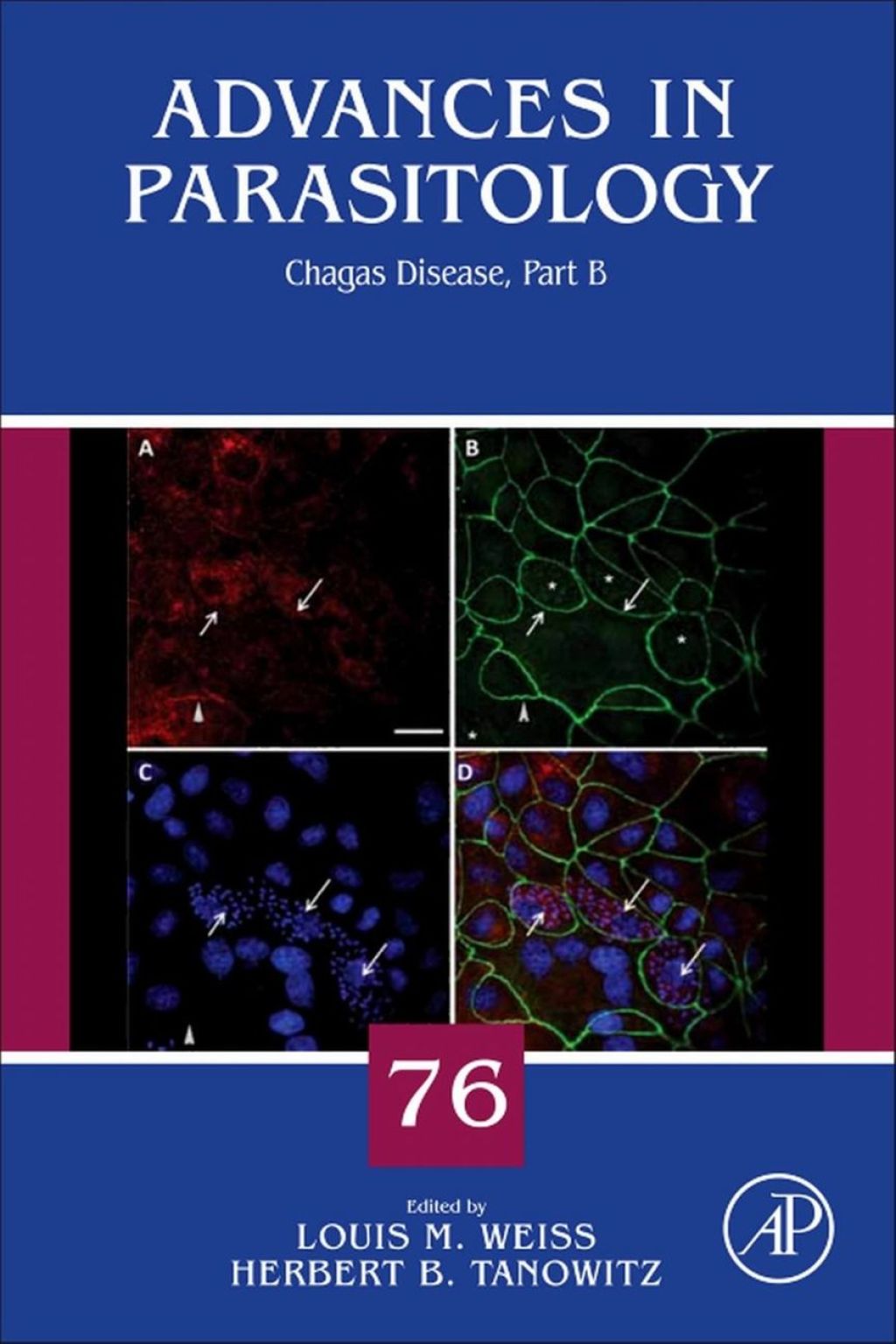 Chagas Disease: Part B â€“ PDF/EPUB Version Downloadable
