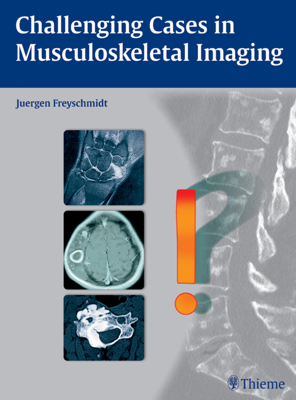 Challenging Cases in Musculoskeletal Imaging 1st Edition â€“ PDF/EPUB Version Downloadable