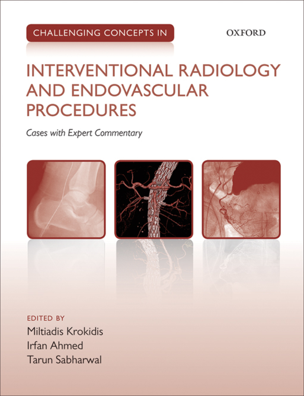 Challenging Concepts in Interventional Radiology 1st Edition â€“ PDF/EPUB Version Downloadable