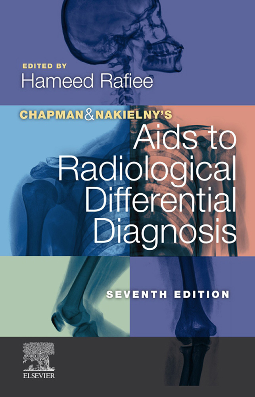 Chapman & Nakielny's Aids to Radiological Differential Diagnosis 7th Edition â€“ PDF/EPUB Version Downloadable