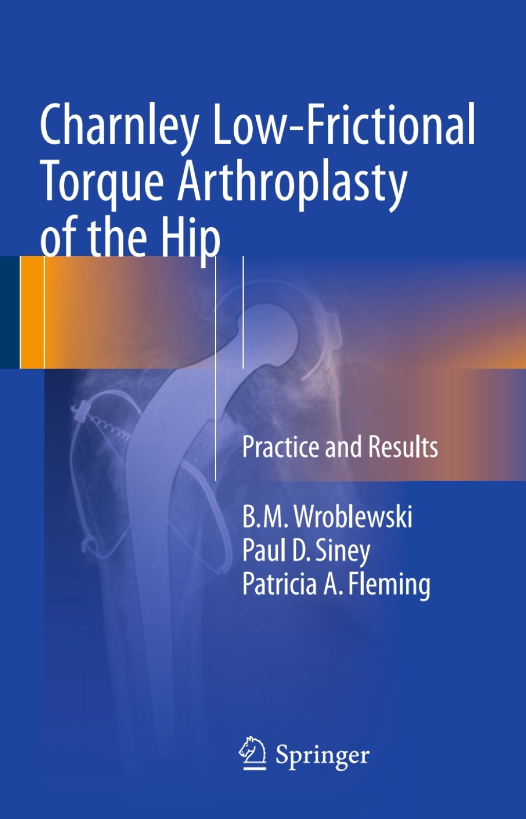 Charnley Low-Frictional Torque Arthroplasty of the Hip Practice and Results â€“ PDF/EPUB Version Downloadable