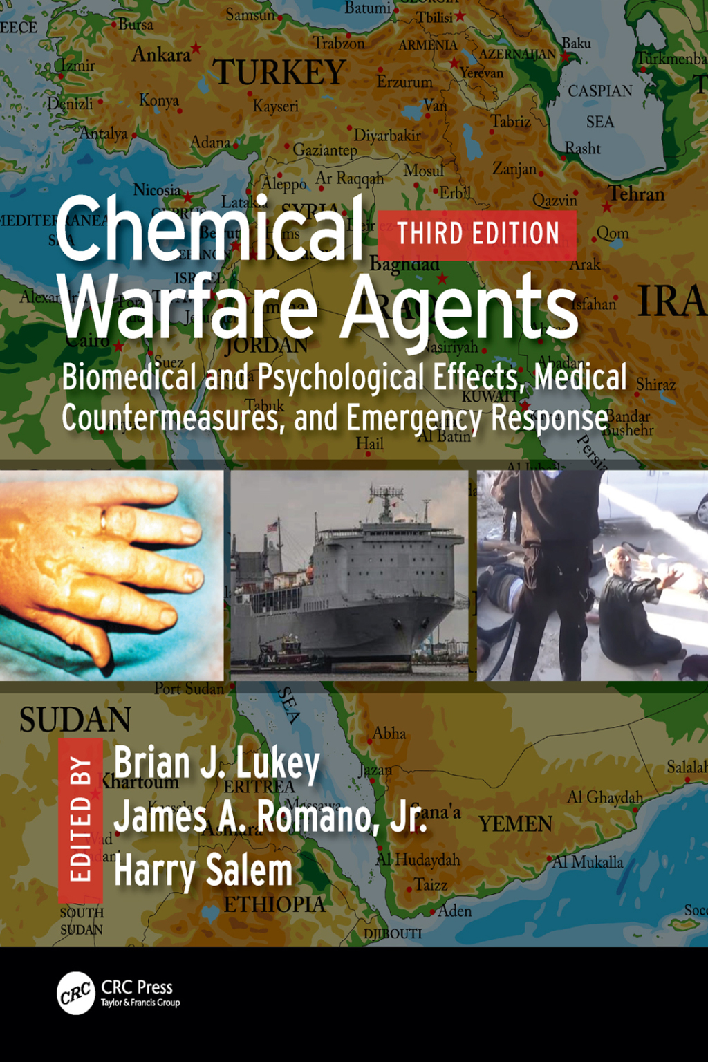 Chemical Warfare Agents Biomedical and Psychological Effects, Medical Countermeasures, and Emergency Response 3rd Edition â€“ PDF/EPUB Version Downloadable