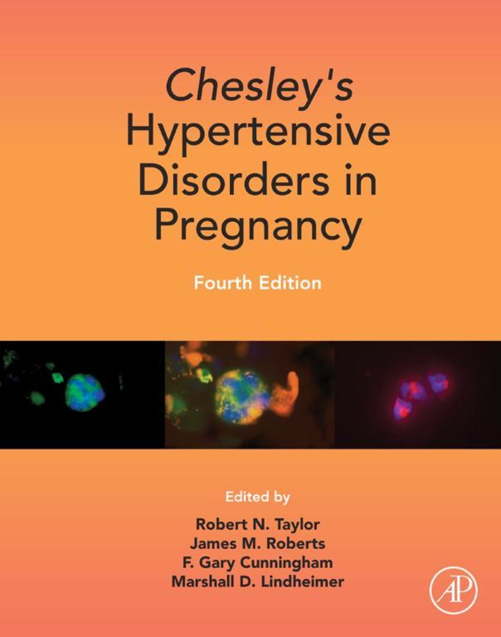 Chesley's Hypertensive Disorders in Pregnancy 4th Edition â€“ PDF/EPUB Version Downloadable
