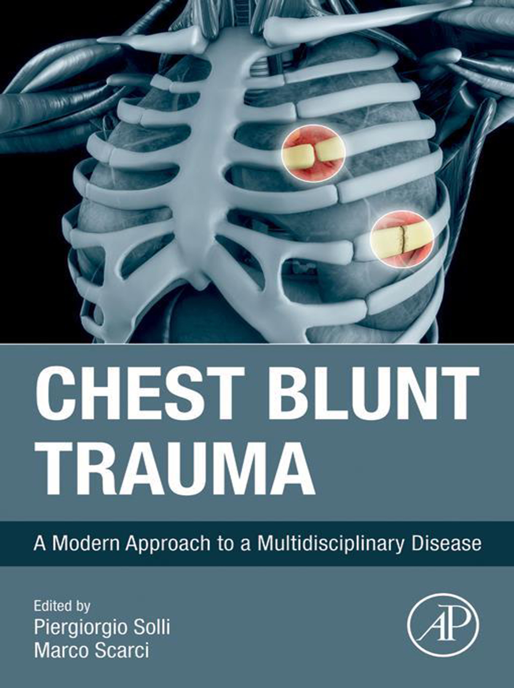 Chest Blunt Trauma A Modern Approach to a Multidisciplinary Disease â€“ PDF/EPUB Version Downloadable