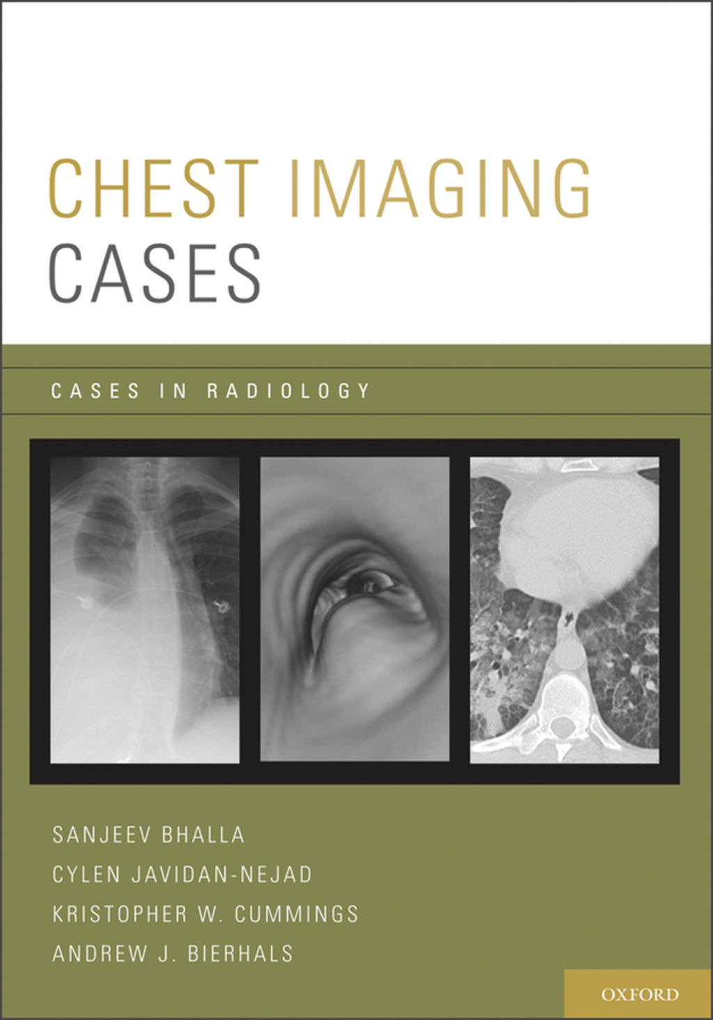 Chest Imaging Cases  â€“ PDF/EPUB Version Downloadable