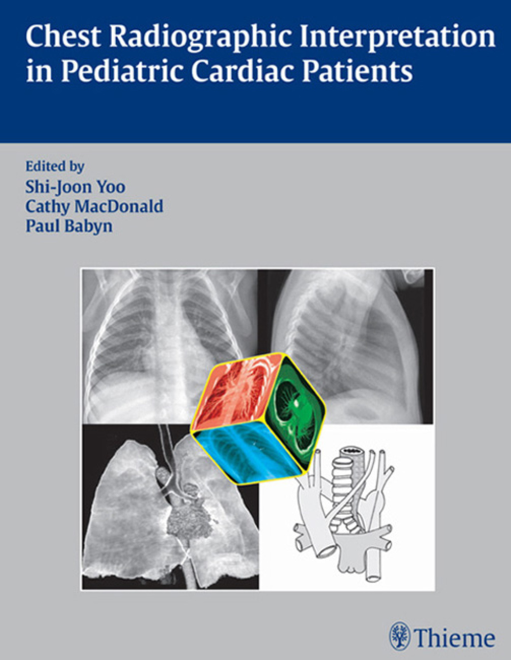 Chest Radiographic Interpretation in Pediatric Cardiac Patients 1st Edition â€“ PDF/EPUB Version Downloadable