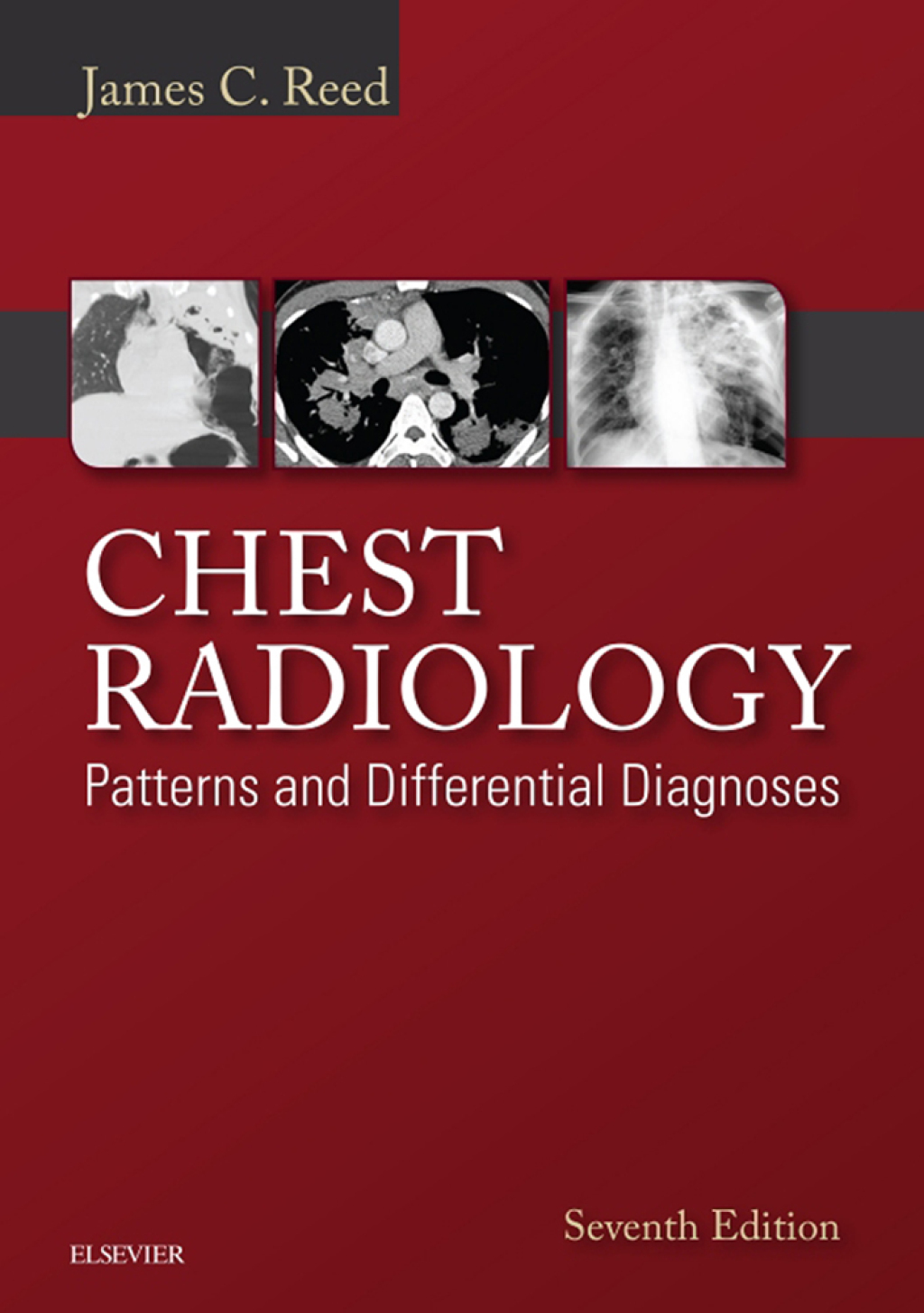 Chest Radiology Patterns and Differential Diagnoses 7th Edition â€“ PDF/EPUB Version Downloadable