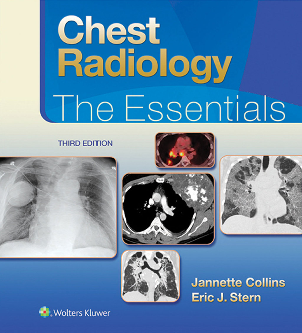 Chest Radiology: The Essentials The Essentials 3rd Edition â€“ PDF/EPUB Version Downloadable