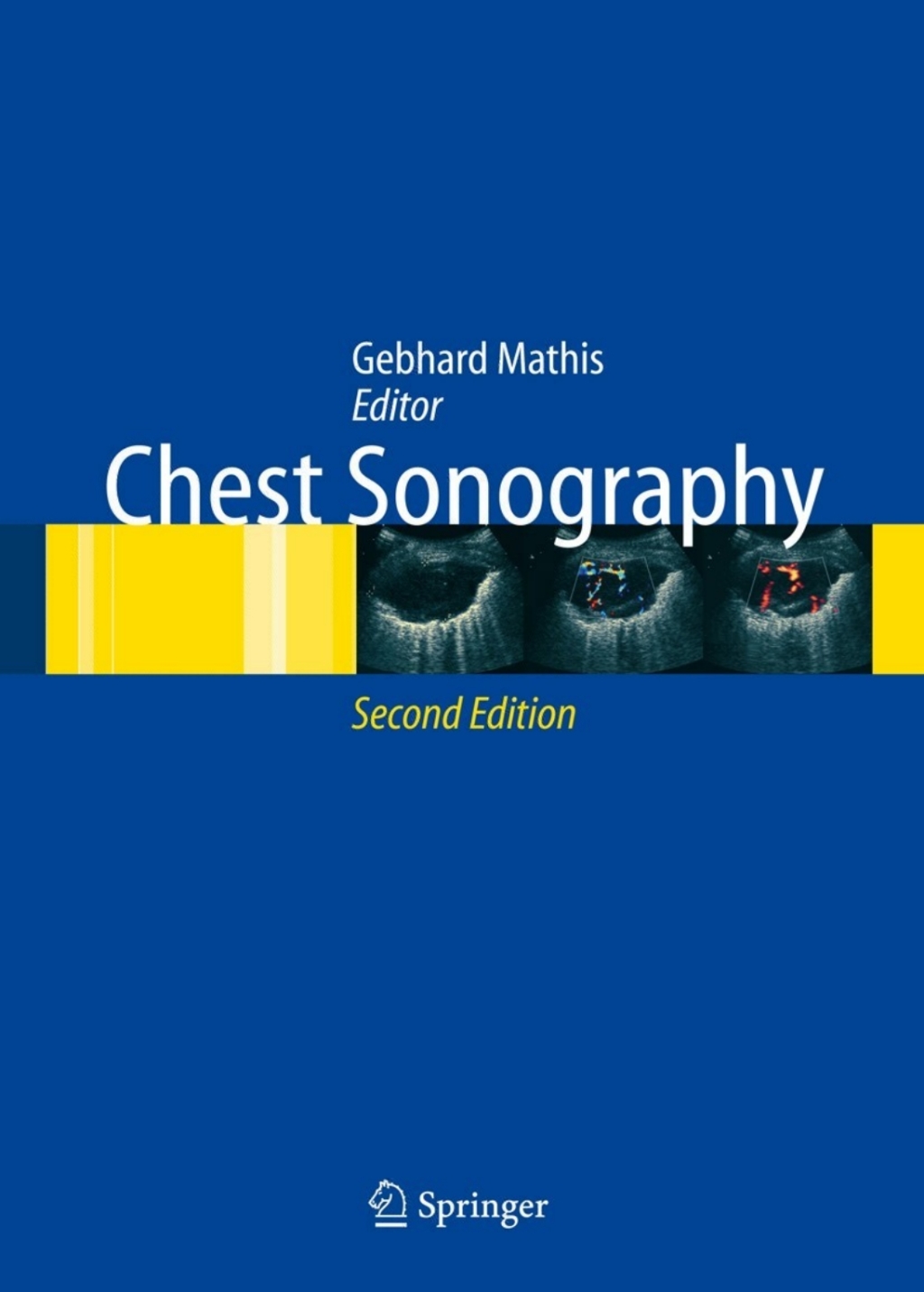 Chest Sonography 2nd Edition â€“ PDF/EPUB Version Downloadable