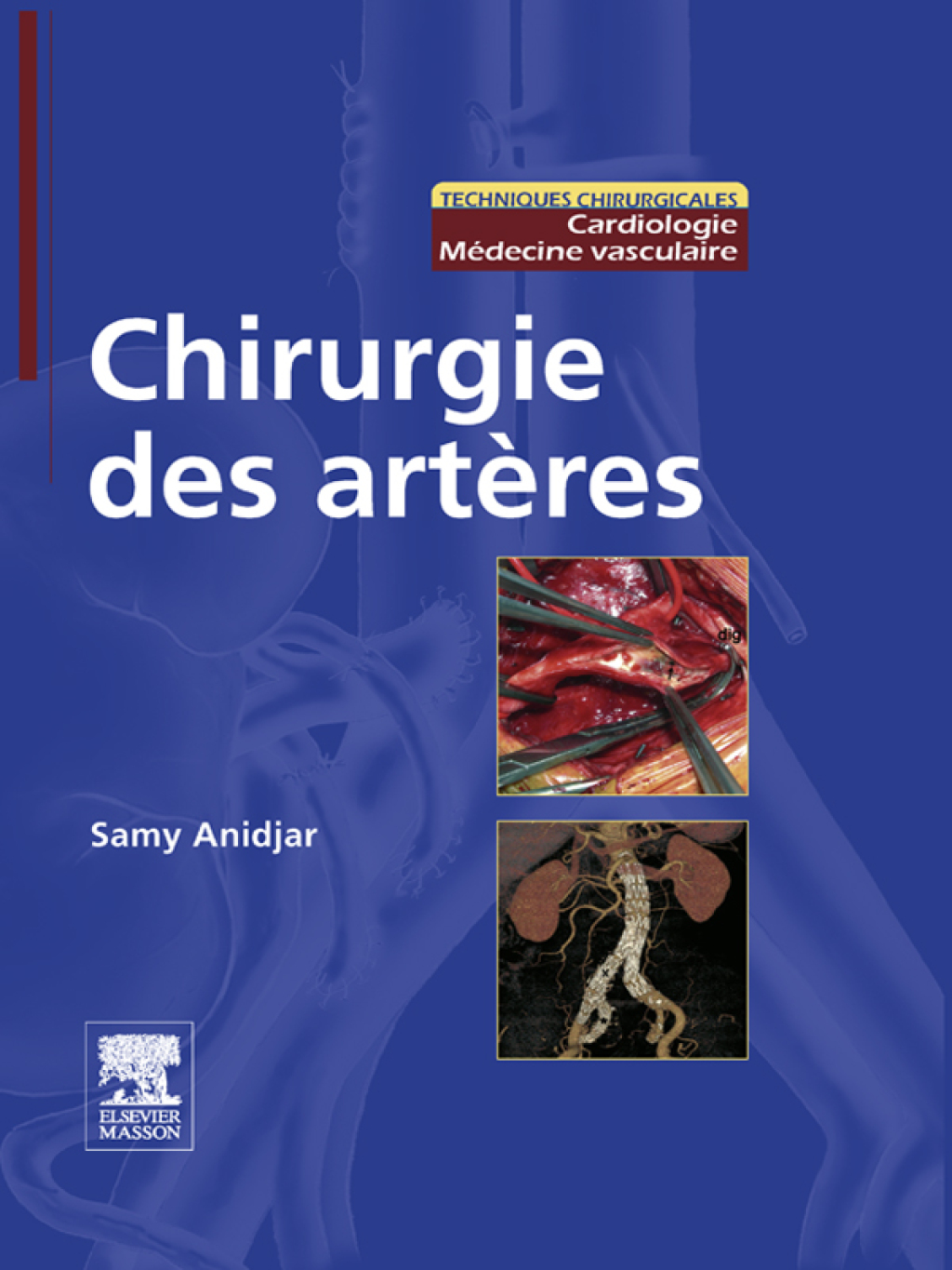 Chirurgie des artÃ¨res â€“ PDF/EPUB Version Downloadable
