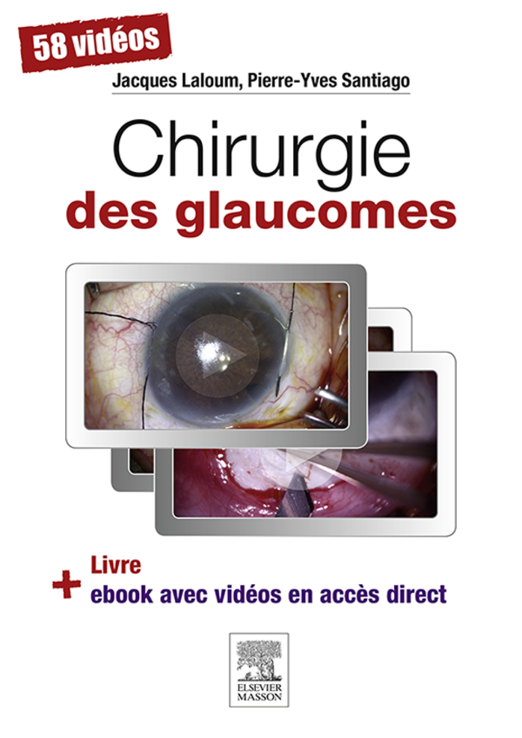 Chirurgie des glaucomes â€“ PDF/EPUB Version Downloadable