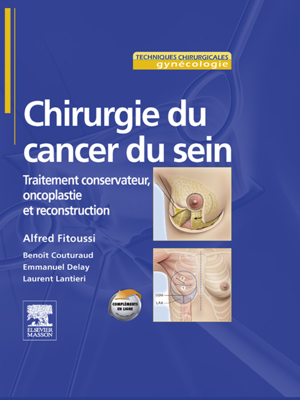 Chirurgie du cancer du sein Traitement conservateur, oncoplastie et reconstruction â€“ PDF/EPUB Version Downloadable