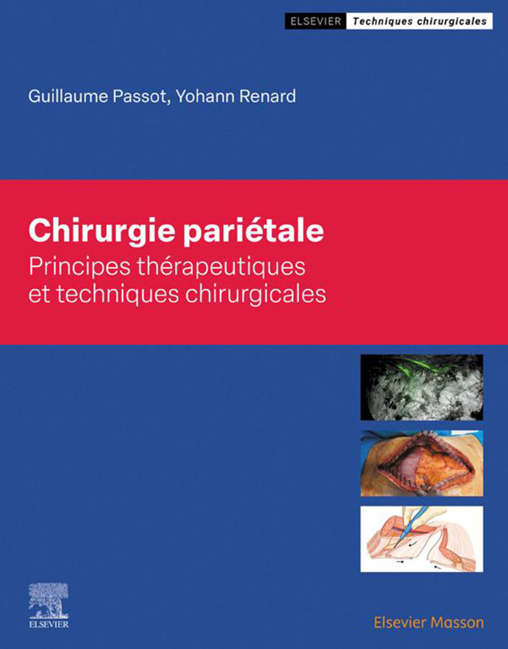Chirurgie pariÃ©tale 1st Edition â€“ PDF/EPUB Version Downloadable
