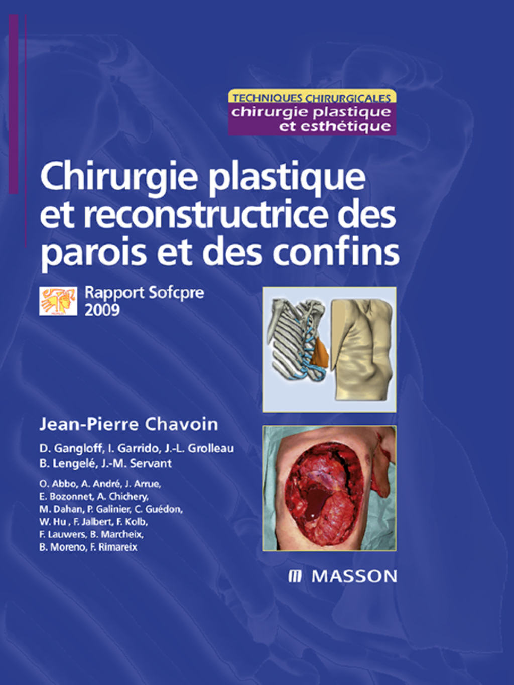 Chirurgie plastique et reconstructrice des parois et des confins Rapport Sofcpre 2009  â€“ PDF/EPUB Version Downloadable