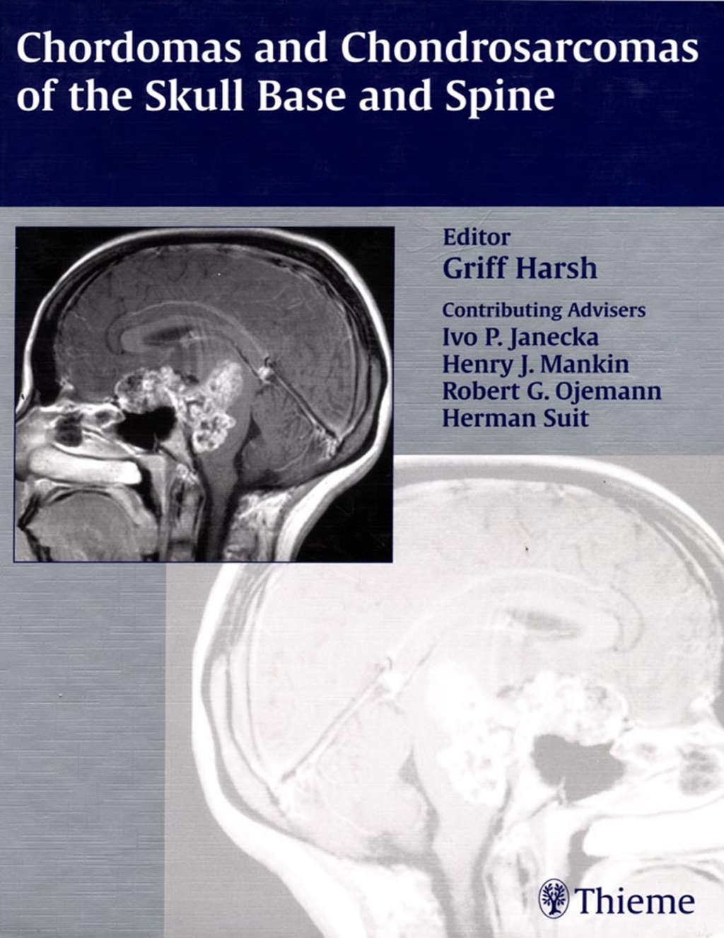 Chordomas and Chondrosarcomas of the Skull Base and Spine 1st Edition â€“ PDF/EPUB Version Downloadable