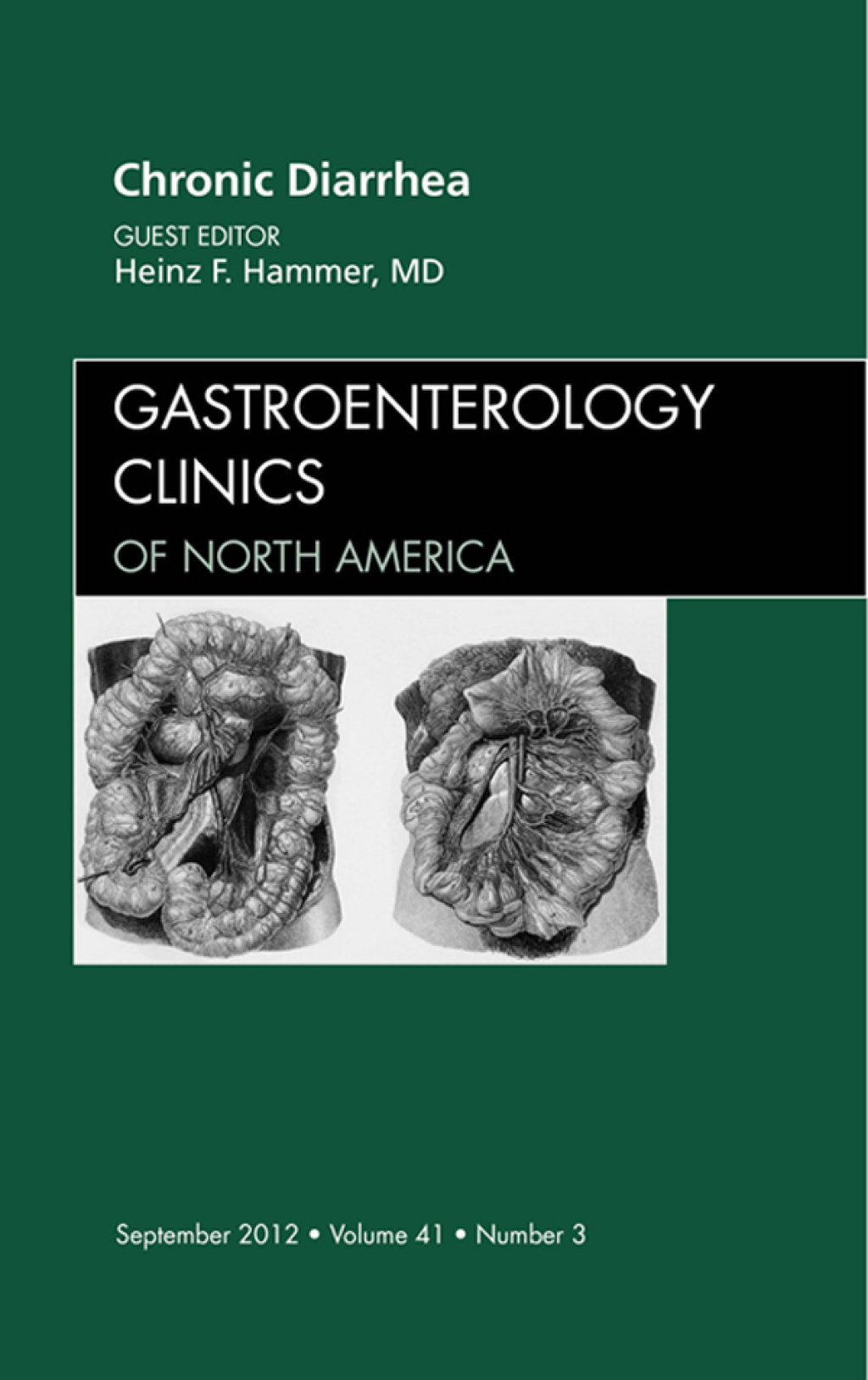 Chronic Diarrhea, An Issue of Gastroenterology Clinics â€“ PDF/EPUB ...