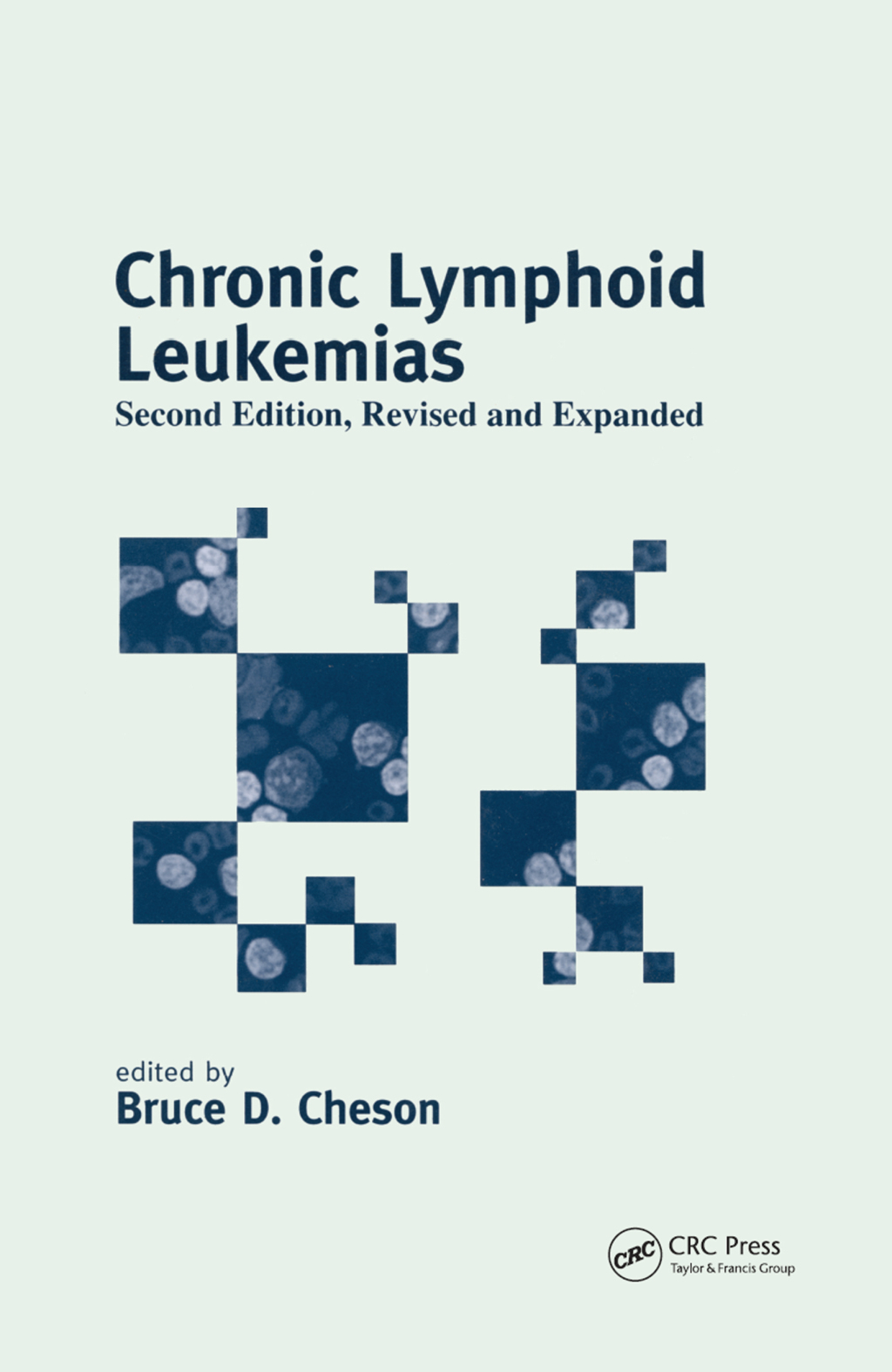 Chronic Lymphoid Leukemias 2nd Edition â€“ PDF/EPUB Version Downloadable
