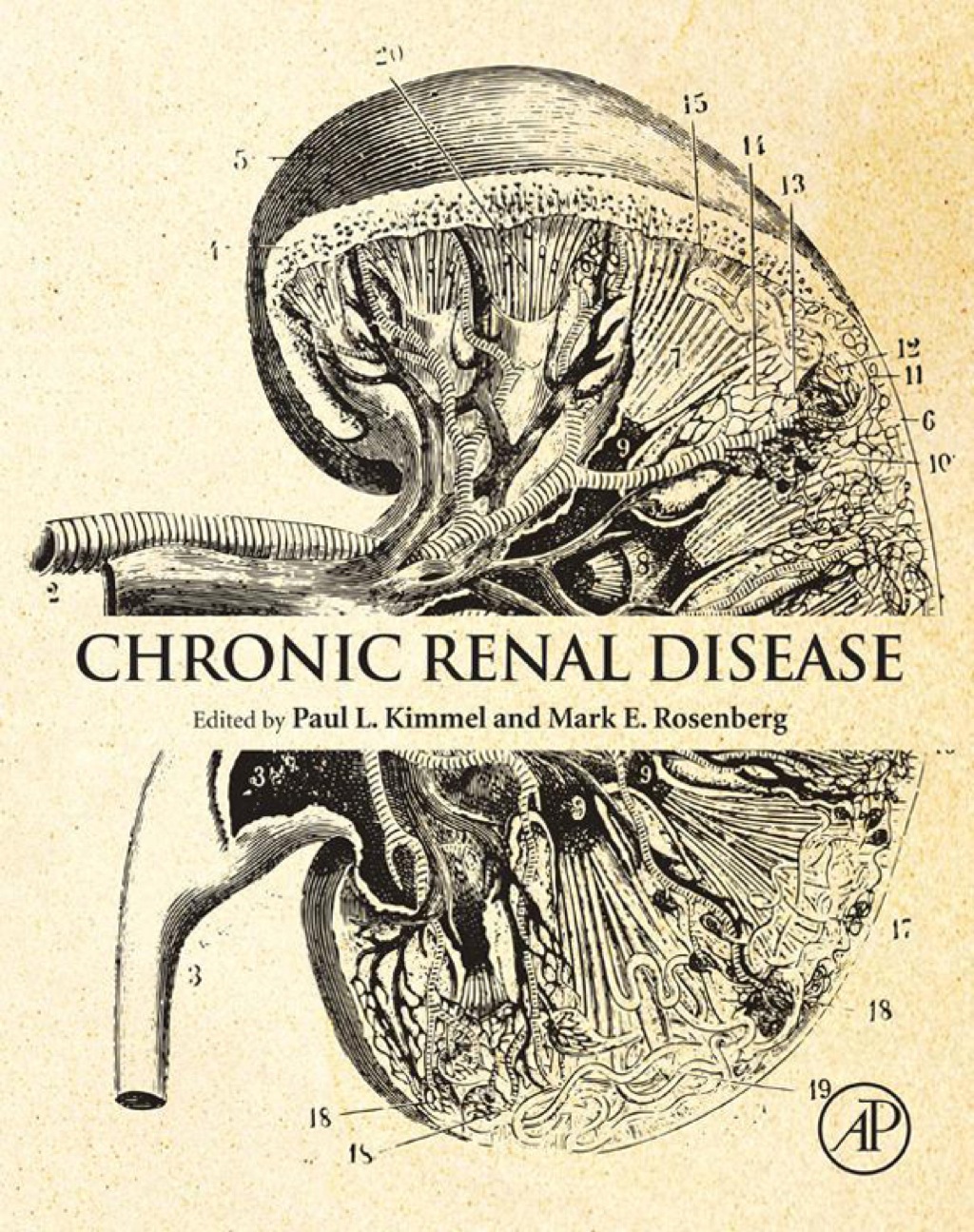 Chronic Renal Disease â€“ PDF/EPUB Version Downloadable