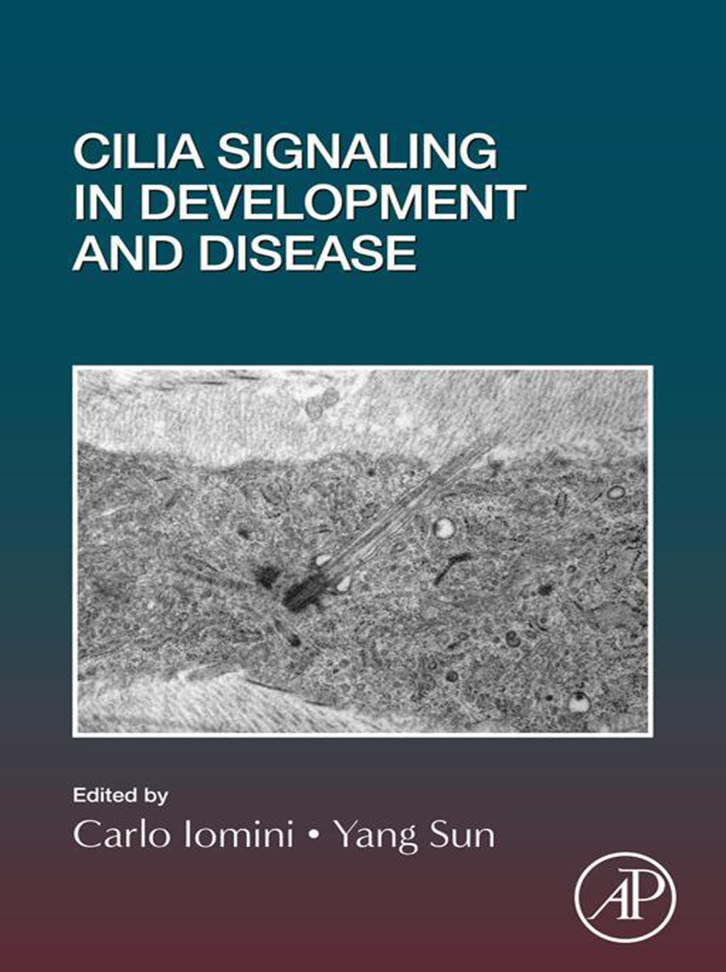 Cilia Signaling in Development and Disease 1st Edition â€“ PDF/EPUB Version Downloadable