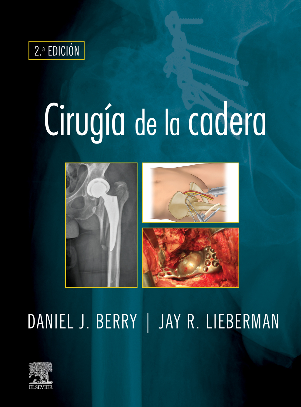 CirugÃ­a de la cadera 2nd Edition â€“ PDF/EPUB Version Downloadable