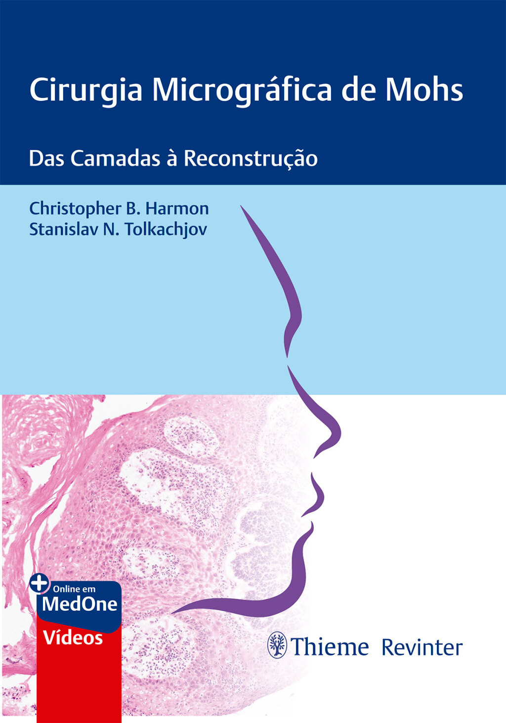Cirurgia MicrogrÃ¡fica de Mohs: Das Camadas Ã  ReconstruÃ§Ã£o 1st Edition â€“ PDF/EPUB Version Downloadable