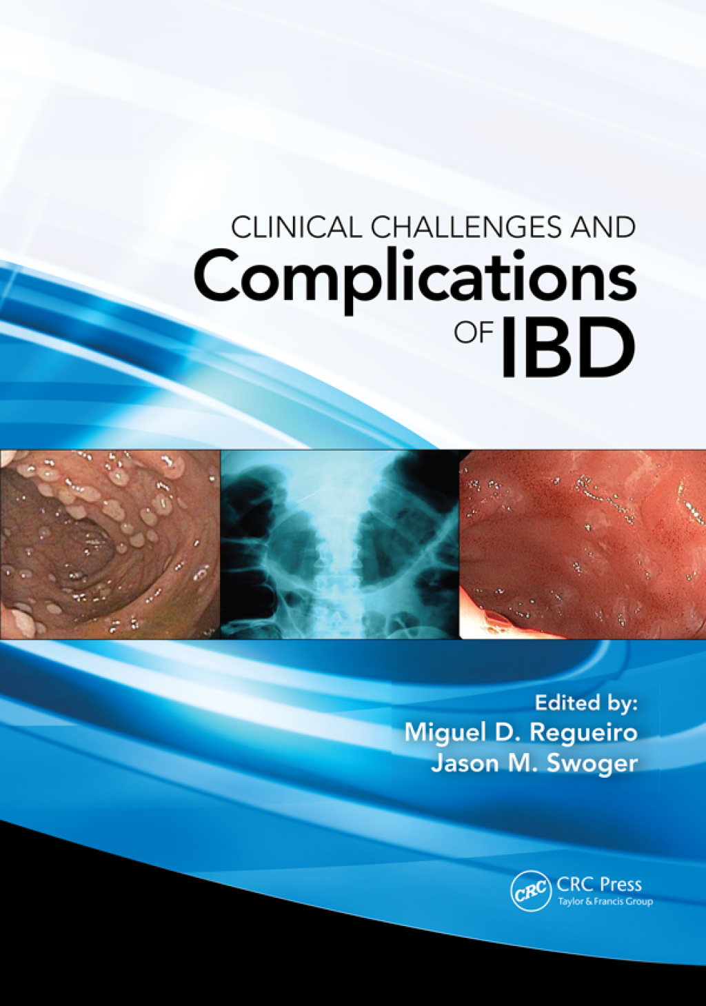 Clinical Challenges and Complications of IBD 1st Edition â€“ PDF/EPUB ...