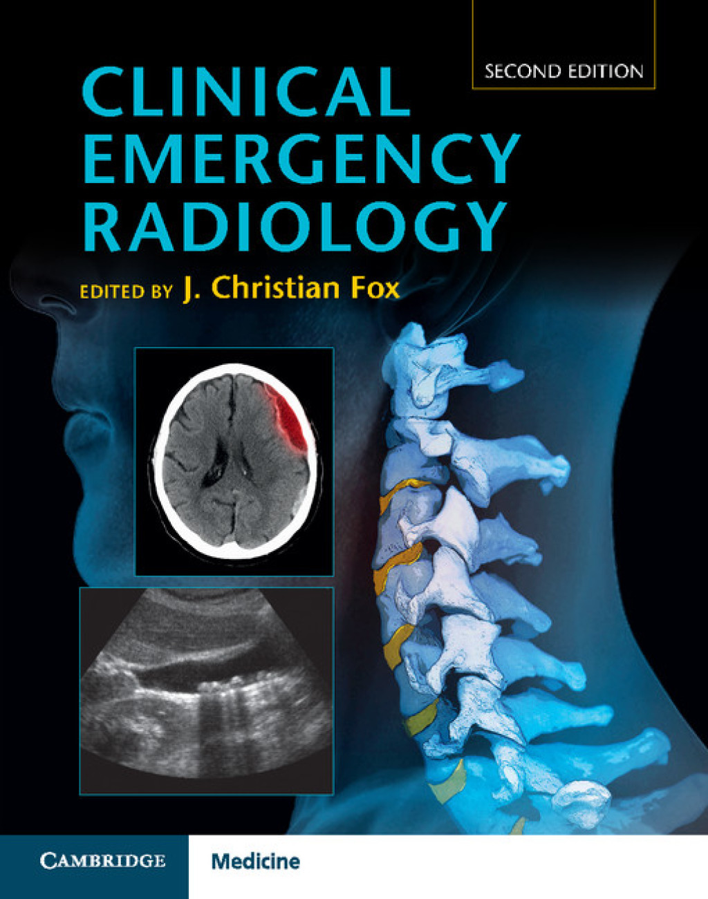 Clinical Emergency Radiology 2nd Edition â€“ PDF/EPUB Version ...
