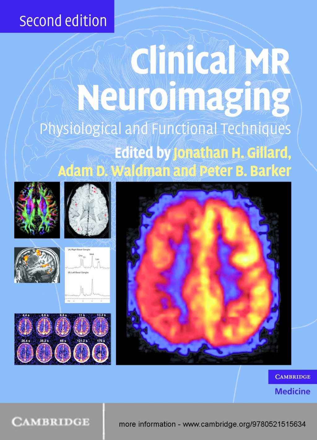 Clinical MR Neuroimaging Physiological and Functional Techniques 2nd ...