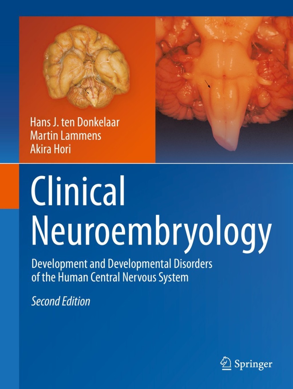 Clinical Neuroembryology Development and Developmental Disorders of the ...
