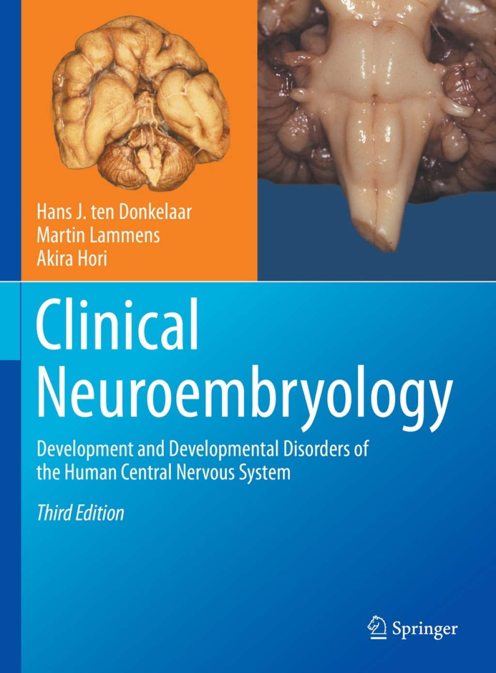 Clinical Neuroembryology Development and Developmental Disorders of the ...