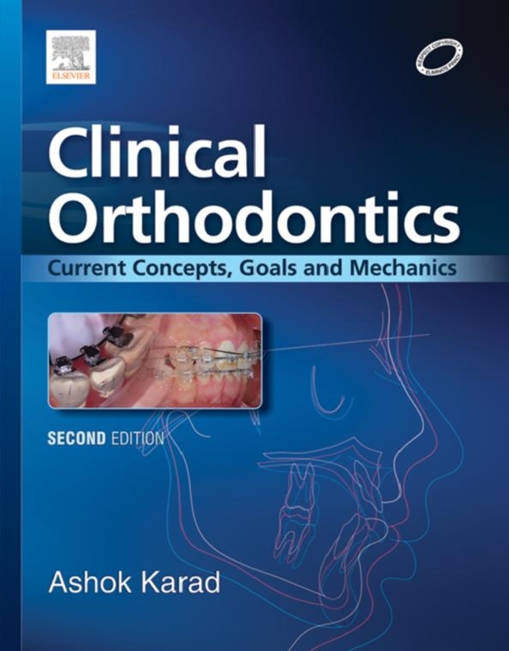 Clinical Orthodontics: Current Concepts, Goals and Mechanics 2nd Edition - (PDF/EPUB Version)
