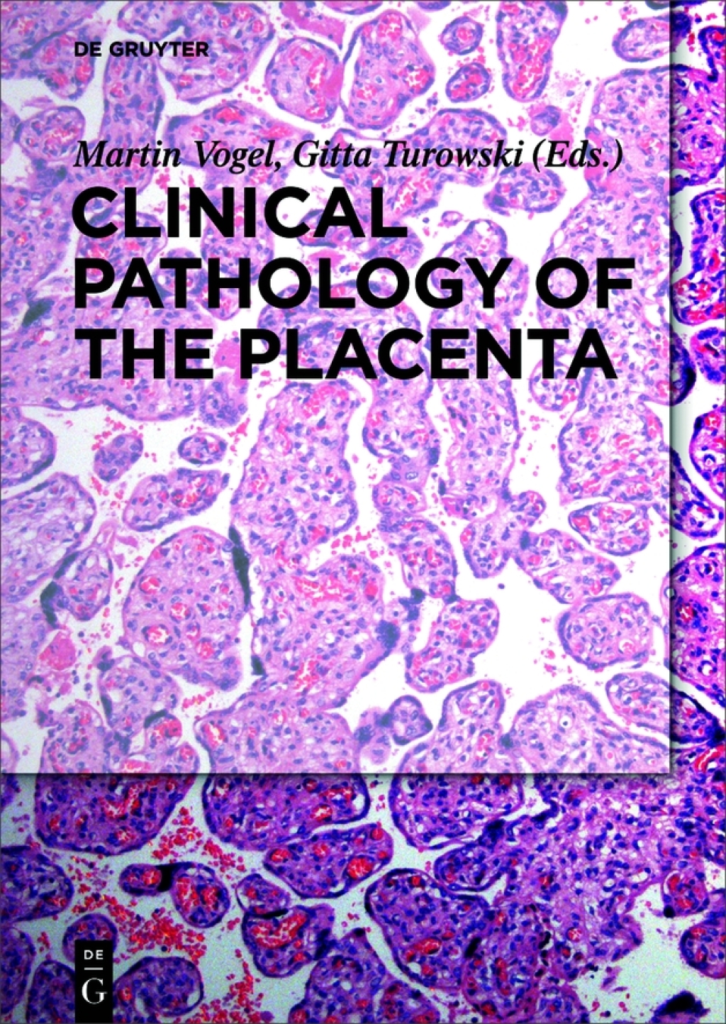Clinical Pathology of the Placenta 1st Edition â€“ PDF/EPUB Version ...