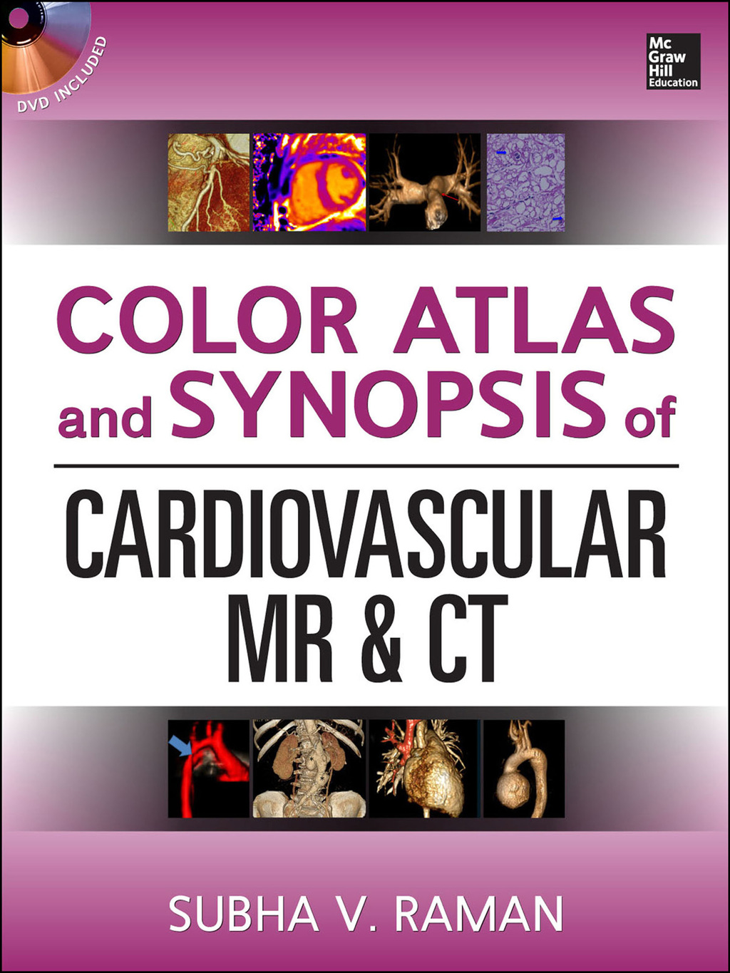 Color Atlas and Synopsis of Cardiovascular MR and CT (SET 2) 1st ...