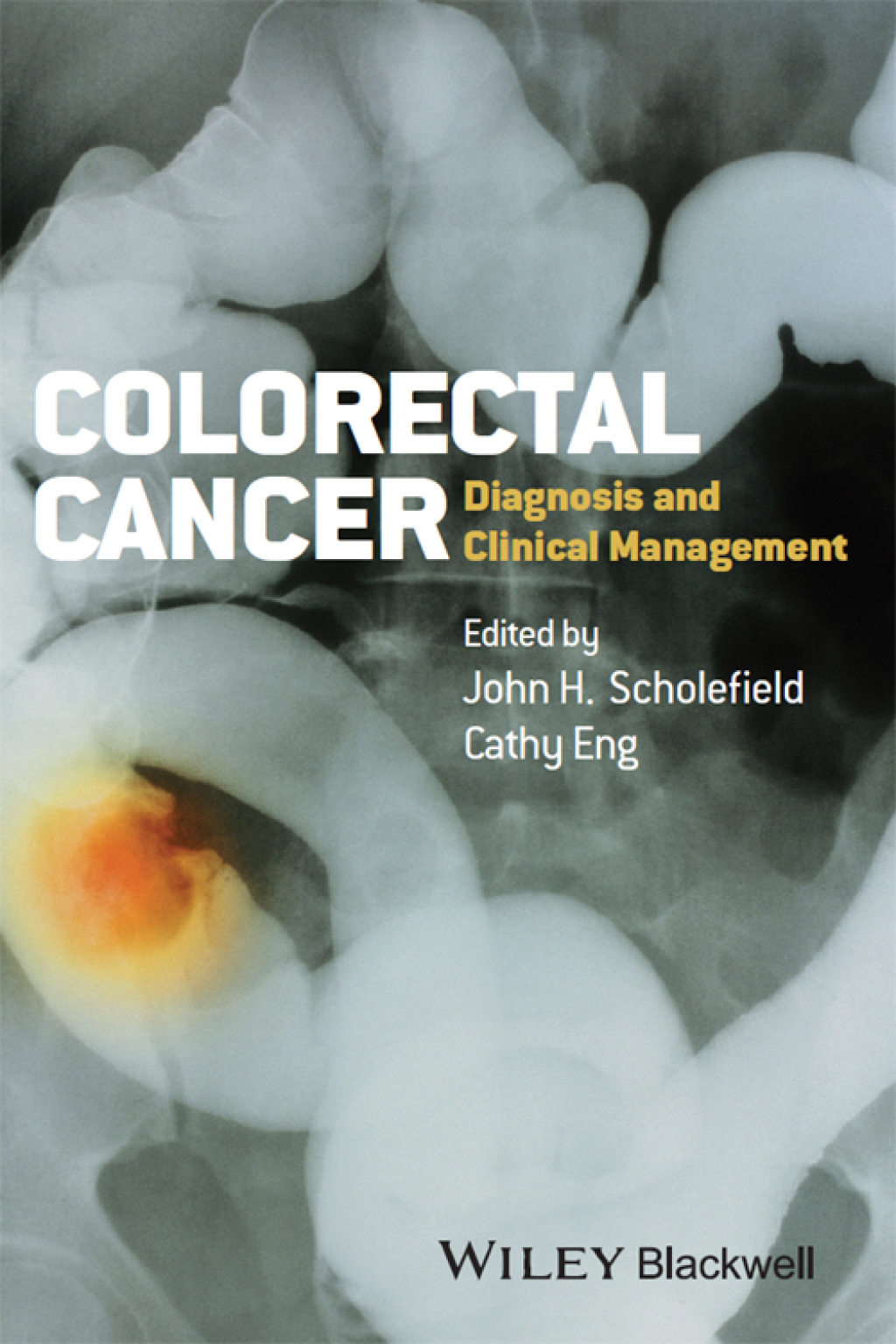 Colorectal Cancer Diagnosis and Clinical Management 1st Edition â€“ PDF ...