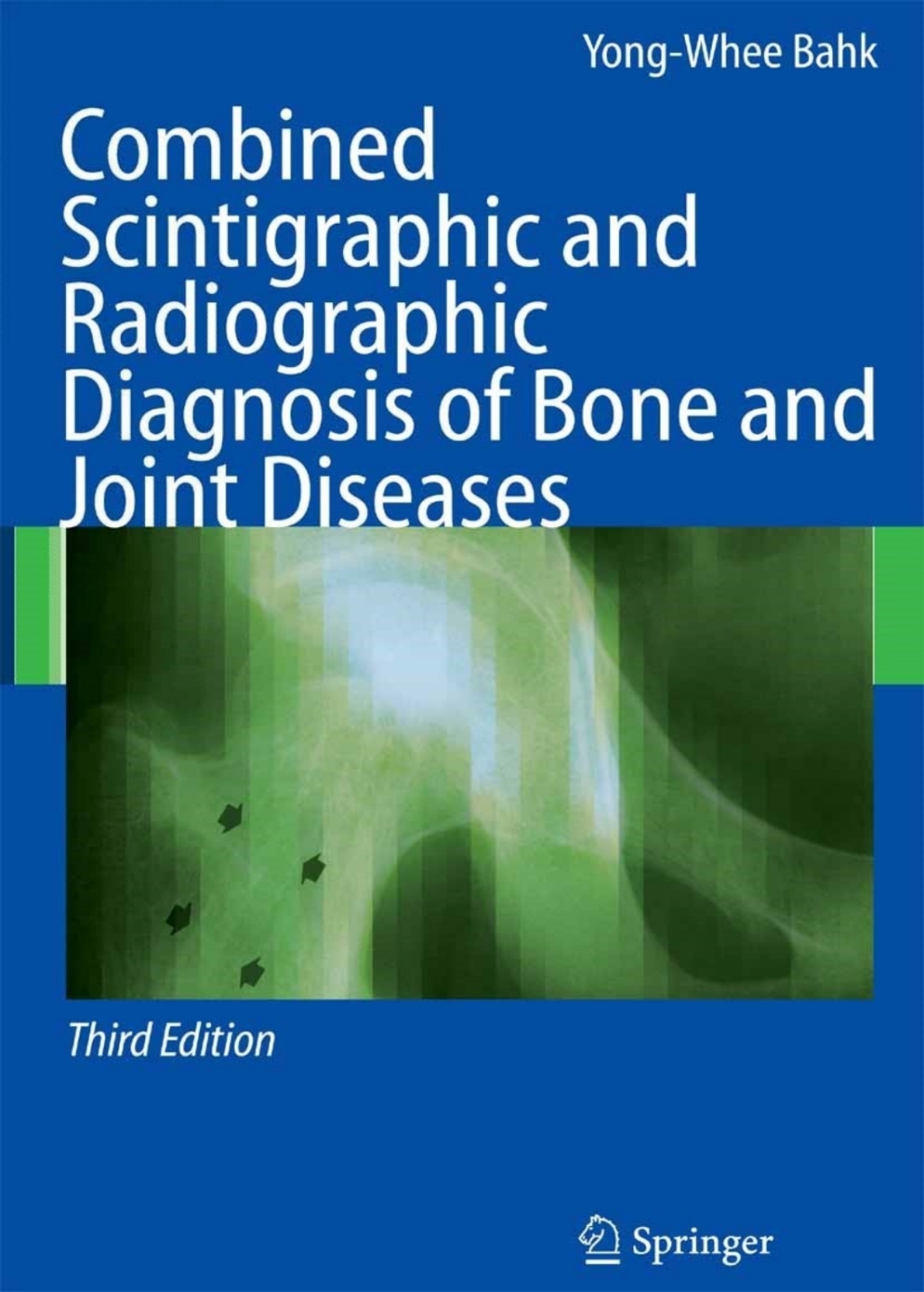 Combined Scintigraphic and Radiographic Diagnosis of Bone and Joint ...